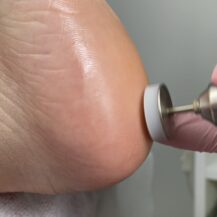 Corso PEDICURE con PODO DISCO in presenza
