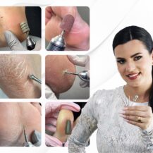 Corso DRY PEDICURE con punte FRESA ‌ in presenza