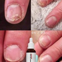 ACTIVE NAIL SOLUTION 30ML